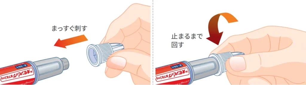 注射針を取り付ける