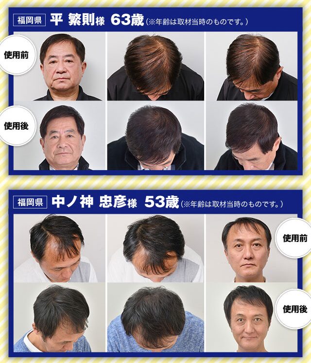 ニューモは効果ない？育毛剤ニューモの特徴と口コミ評判調査！ | Base 