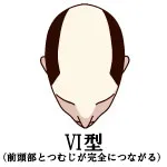 VI型