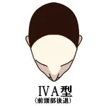 IVA型