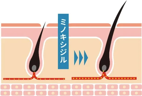 ミノキシジルの作用