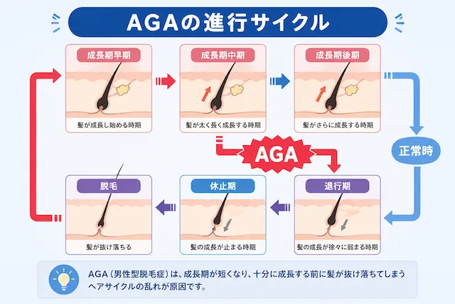 AGAヘアサイクル